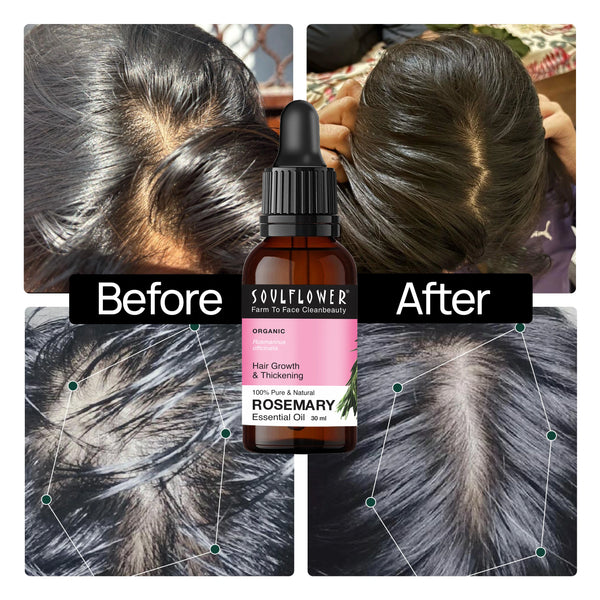 Soulflower Clinically Proven Rosemary Essential Oil for Hair Growth