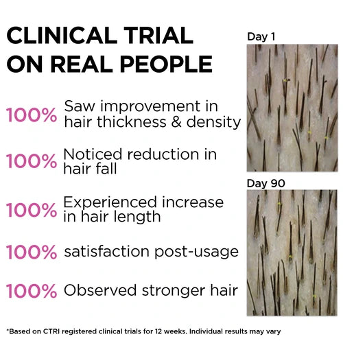 Soulflower Clinically Proven Rosemary Essential Oil for Hair Growth