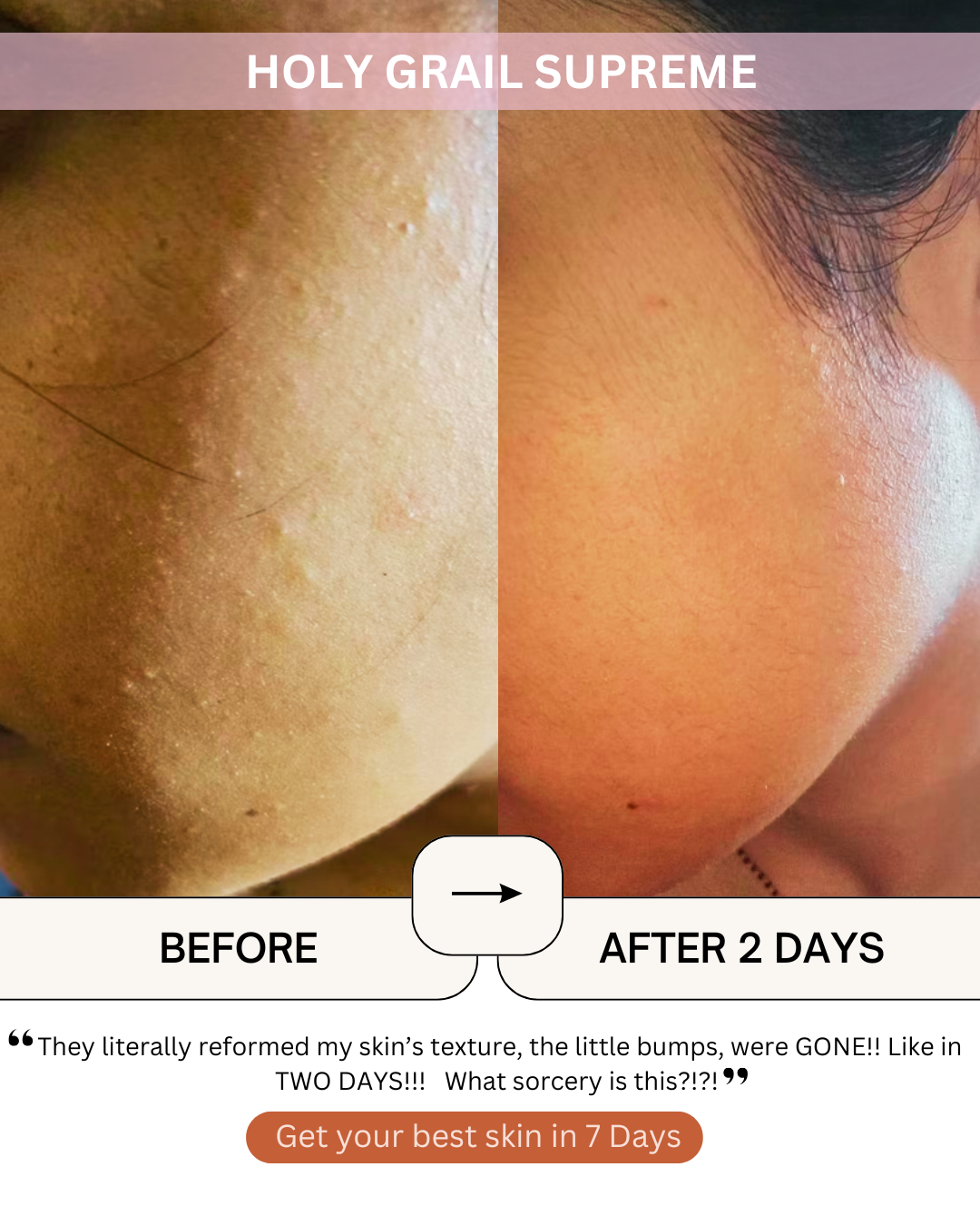 Murshmallow HOLY GRAIL SERUM SUPREME [Moisturiser]