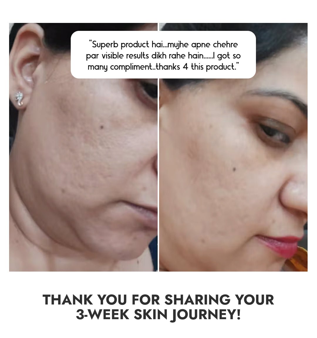CosIQ Niacinamide Vitamin B3-20% Serum 60ml